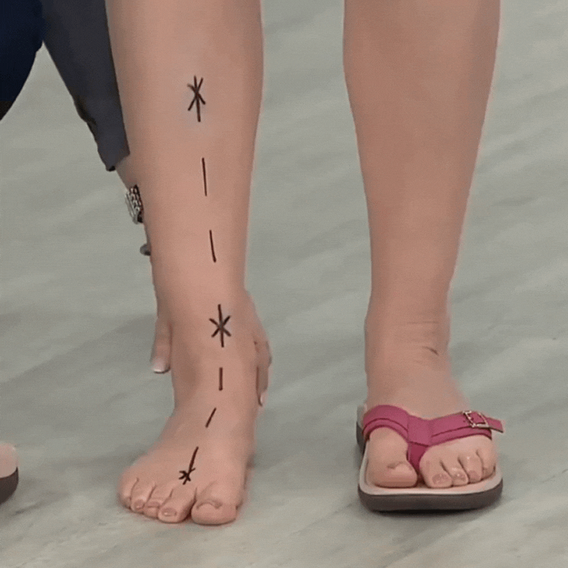 Sigrid | Orthopädische Sommersandalen